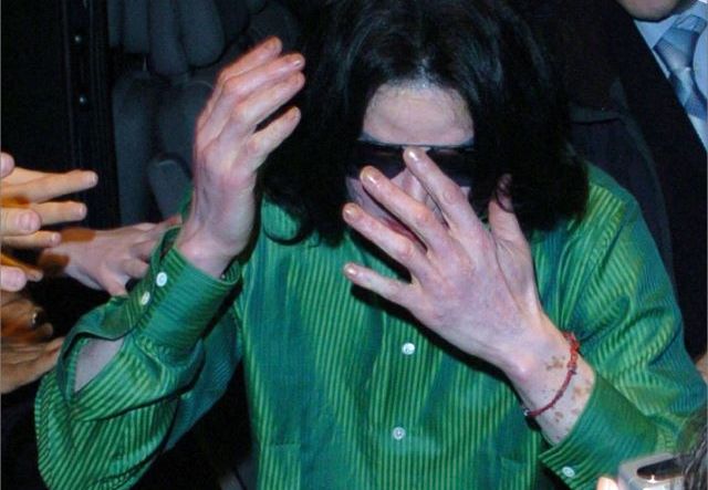 Video verità  sulla pelle di Michael Jackson : vitiligine